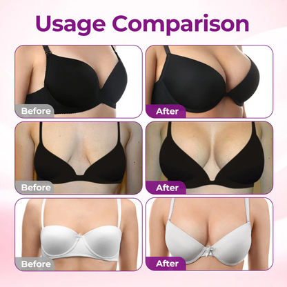 💥Turonu® 🥛 Targeted Breast Enhancement Advanced Nano Microneedle Patch💃