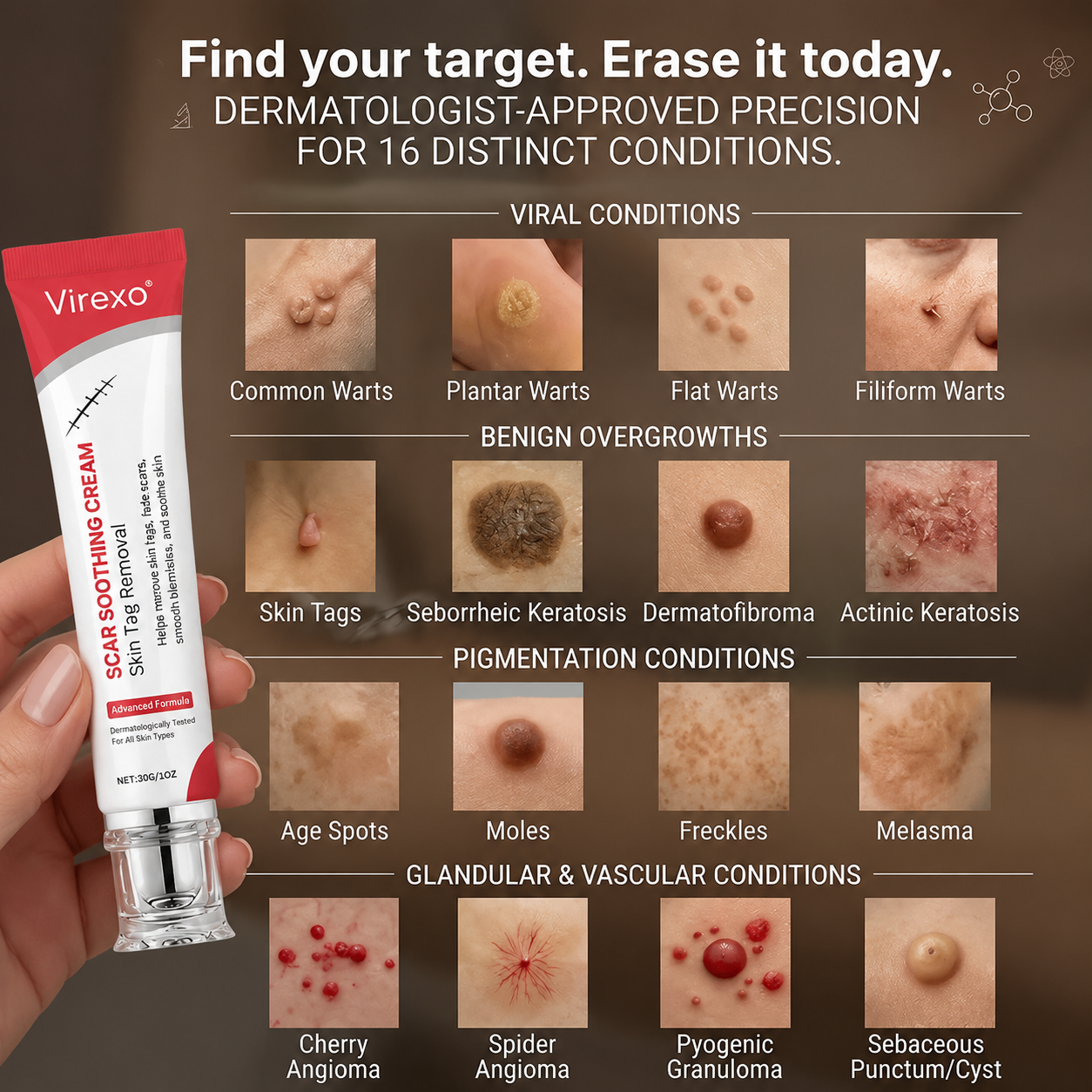 Virexo Scar Soothing Cream – Effective Skin Tag