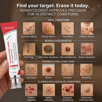 Virexo Scar Soothing Cream – Effective Skin Tag